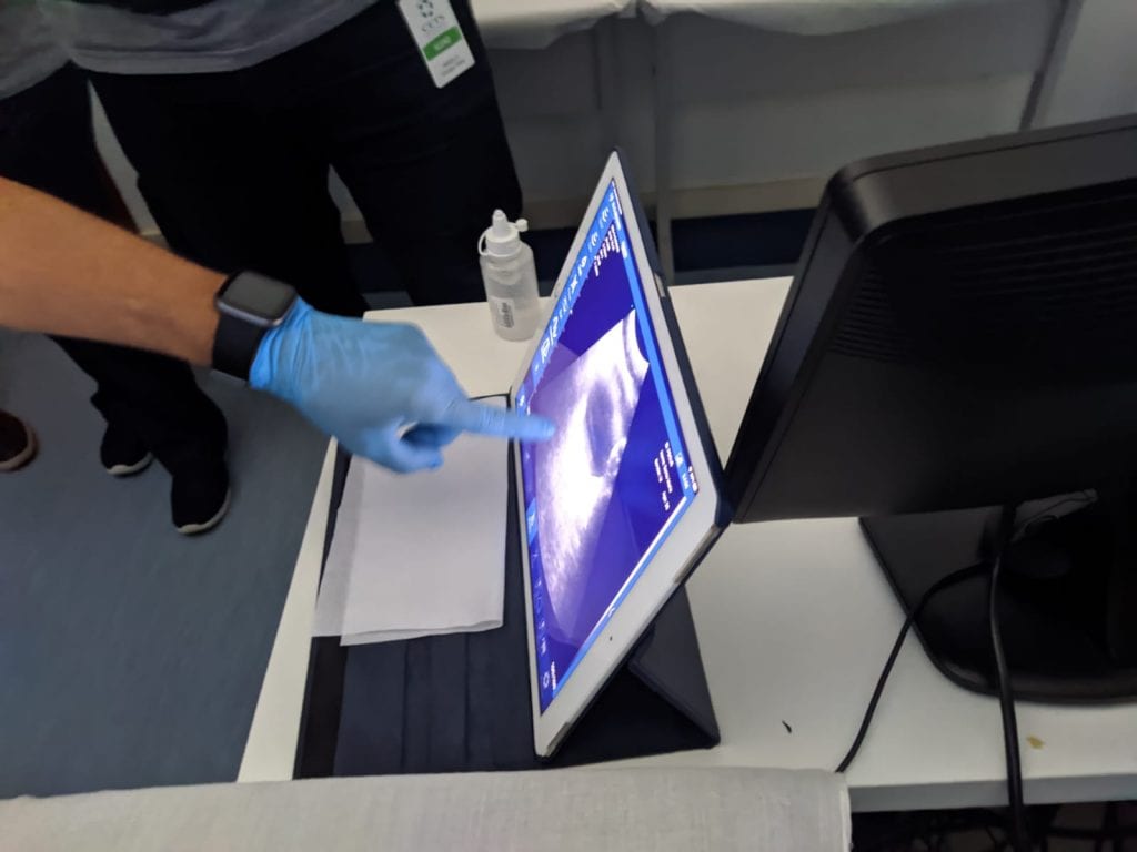 Ultrassom Point of Care